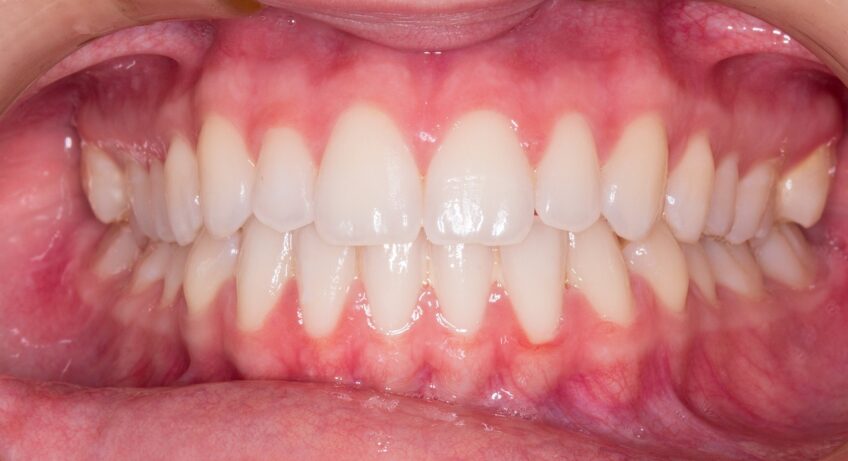teeth