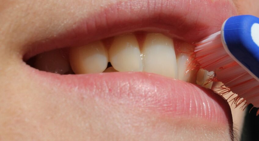 teeth