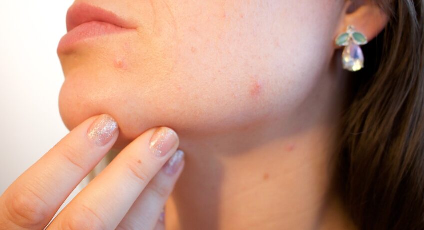 skin